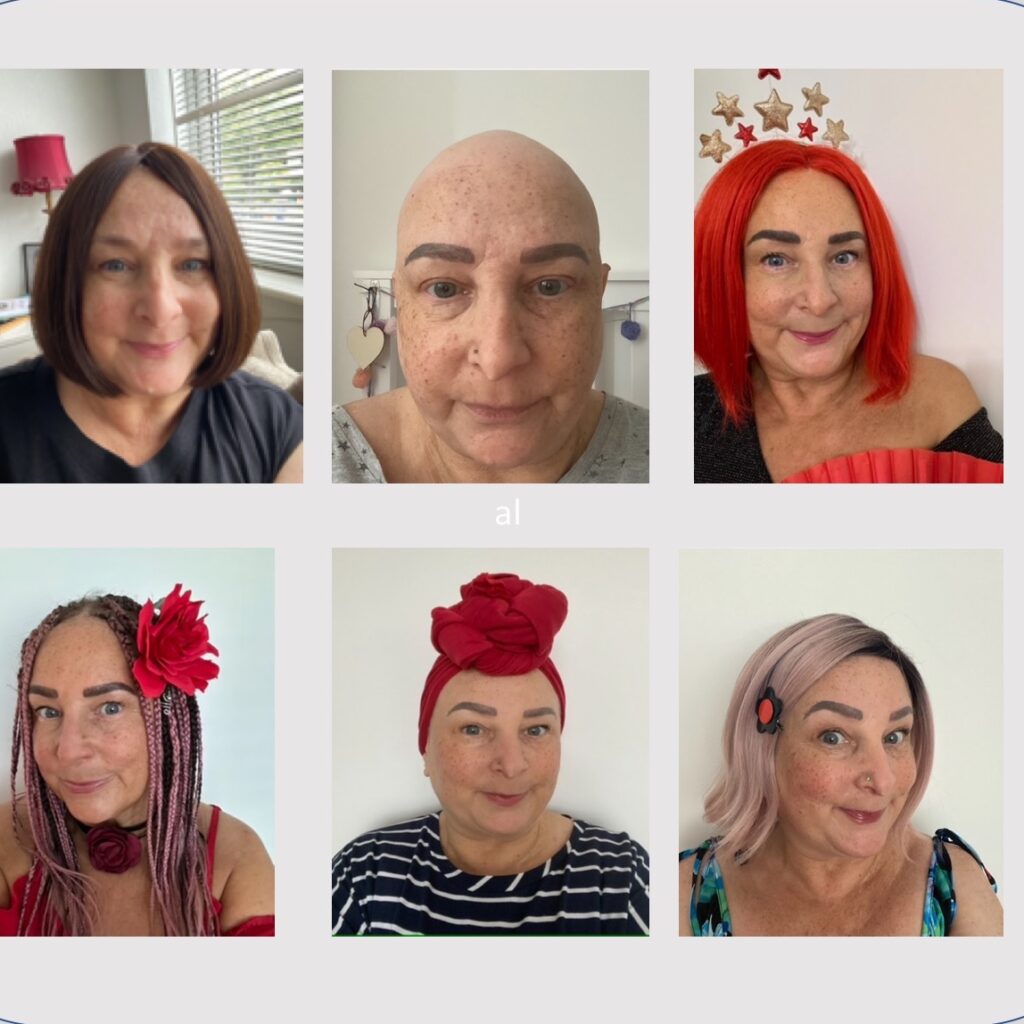 Pictures from normal hair to shaved hair, to wigs